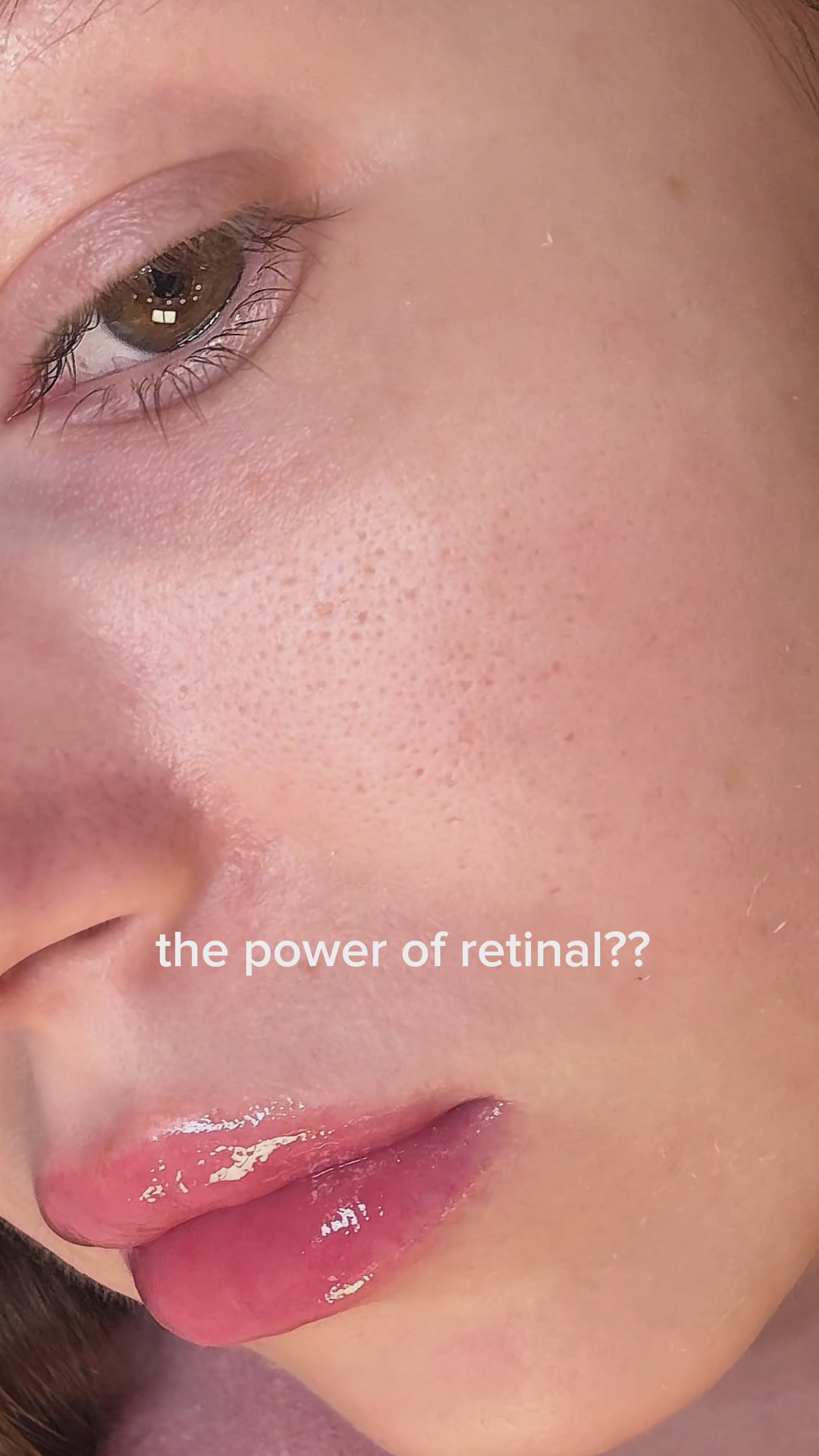 The Vita-A Retinal Shot Tightening Booster - 15 ml